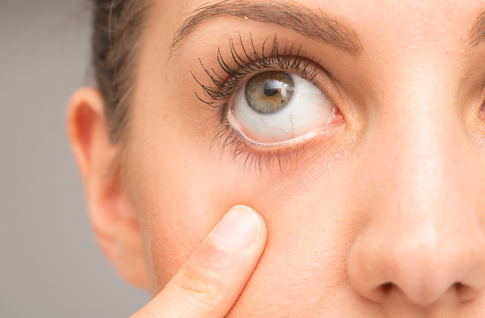 Dry Eye Hygiene & Eyecare Consultations